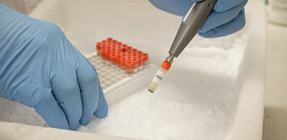 Picture of the News article Blood samples for “Early Cancer Detection with Lasers” (ECDL) research